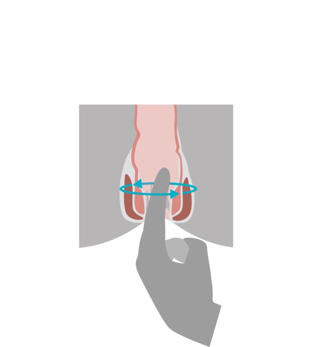 Illustrasjonsbilde av finger som roterer nederst i analkanalen for å sette i gang bevegelse i tykktarmen
